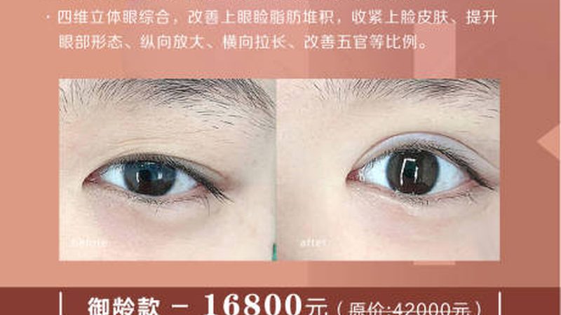 医美机构消毒隔离规范：守护美丽，安全先行