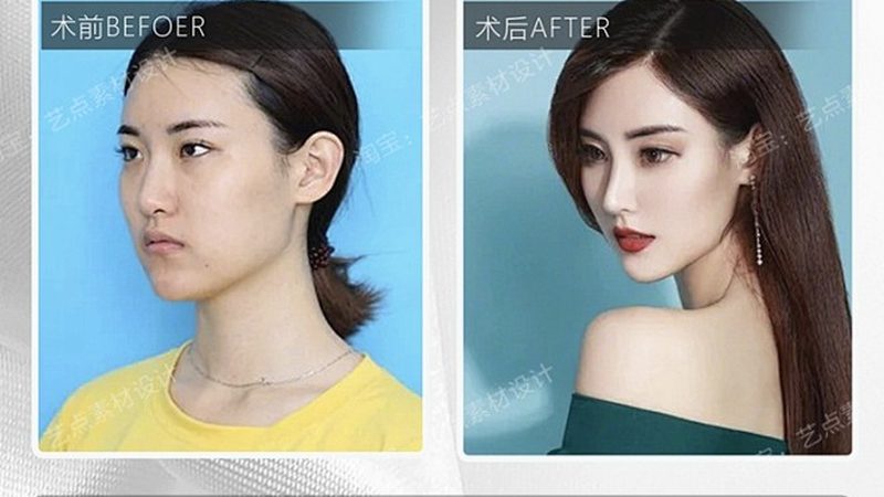 医美咨询师加盟公司推荐