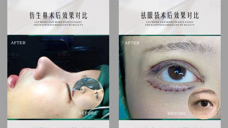 国产水光针，揭秘其背后的科技与选择之道