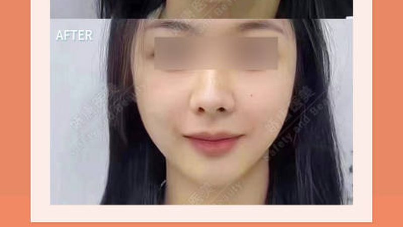 轻医美仪器十大品牌排名