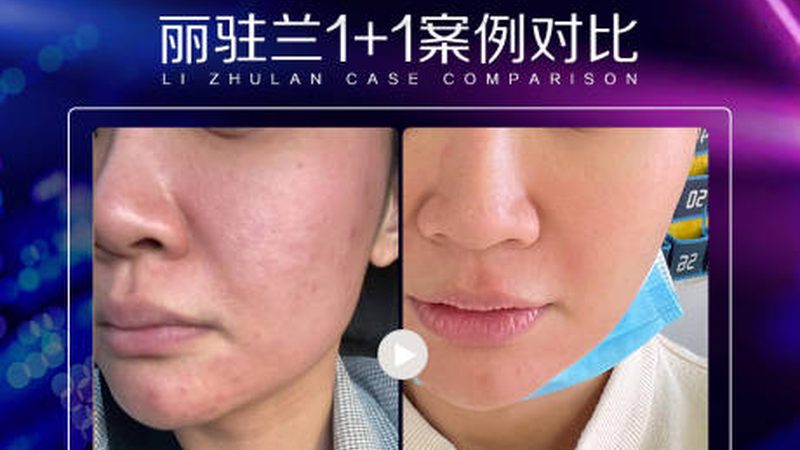 揭秘上海三甲整形医院排名背后的考量因素
