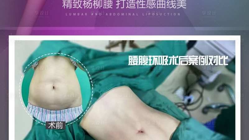 轻医美皮肤管理仪器参数对比