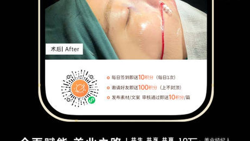 医美流程步骤哪家好