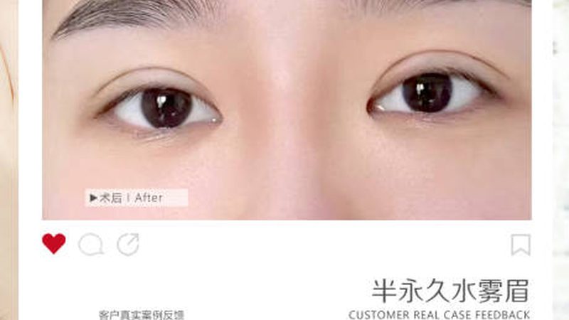 瘦脸绷带真的无副作用？使用前必看注意事项**