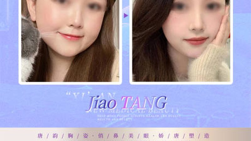 瘦脸精华液和V脸面膜对比