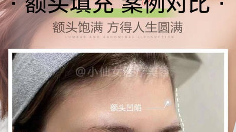 轻松告别大脸困扰，瘦脸贴片使用攻略全解析