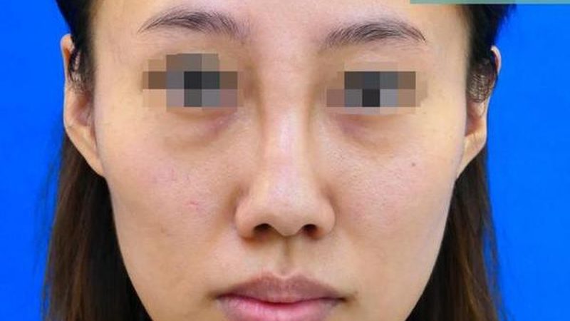 医美咨询师行业标准揭秘：如何选择专业可靠的咨询顾问